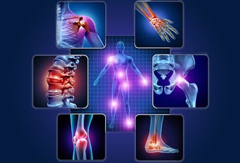 Best Turmeric Ashwagandha Latte Mix Manufacturer In India| Natural Remedies For Knee Pain